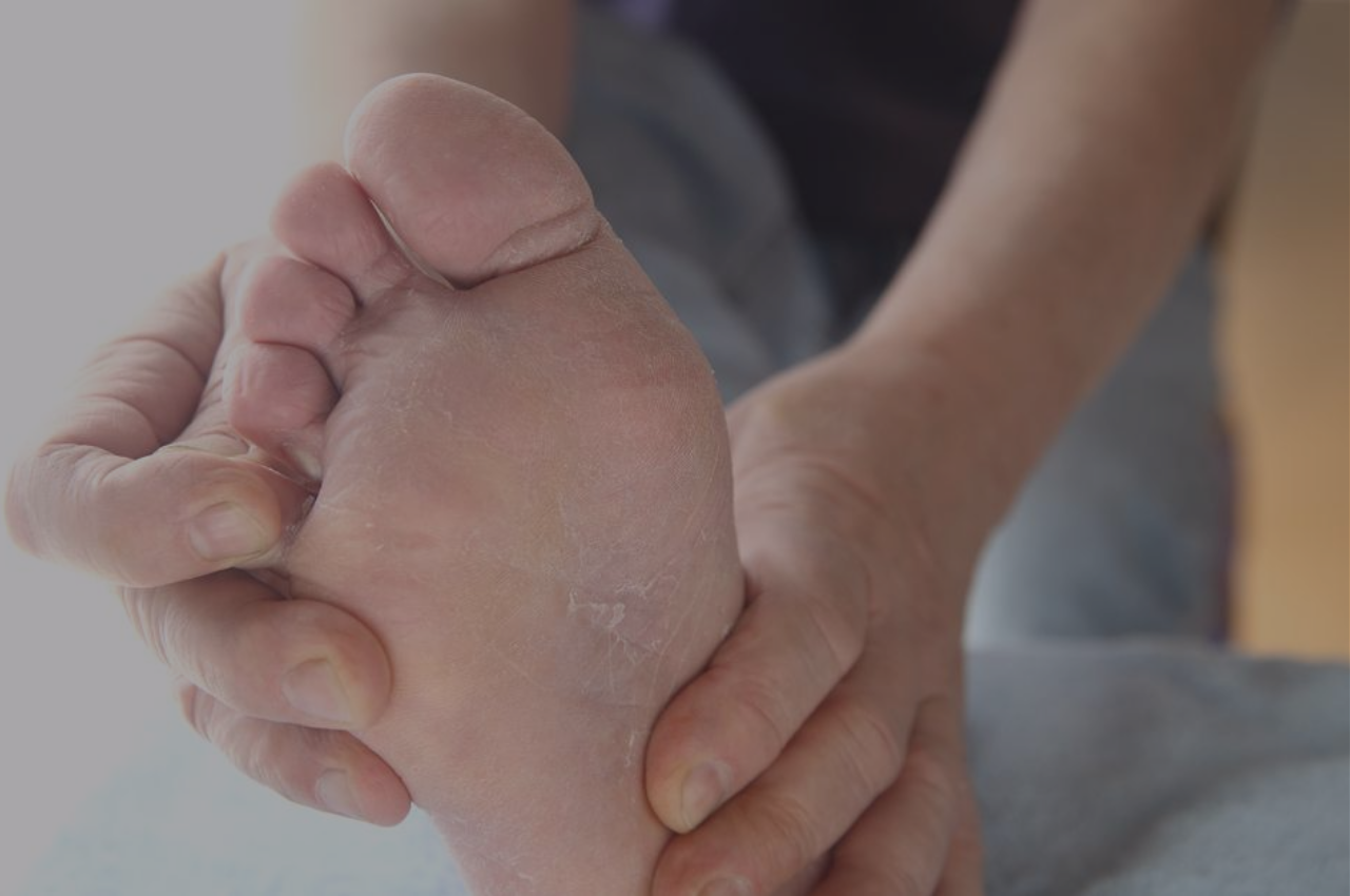 athletes foot sufferer wondering if an athletes foot home remedy is right for them 