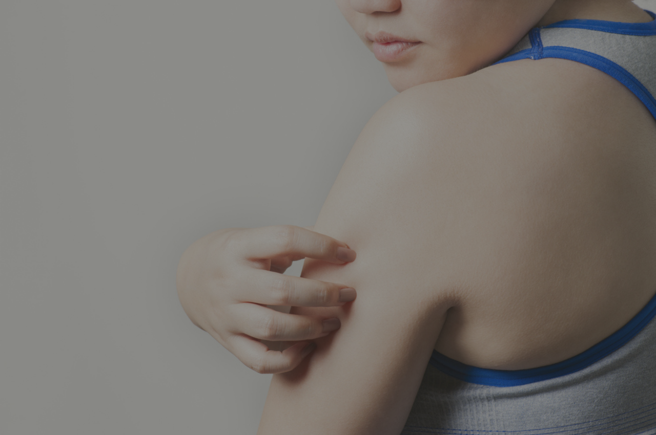 woman with ringworm from the gym wondering how to prevent jock itch and ringworm from the gym