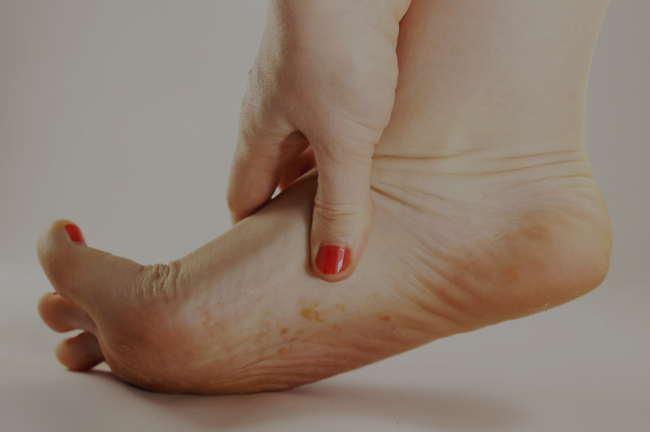Woman with itchy foot wondering if she has foot eczema or athletes foot