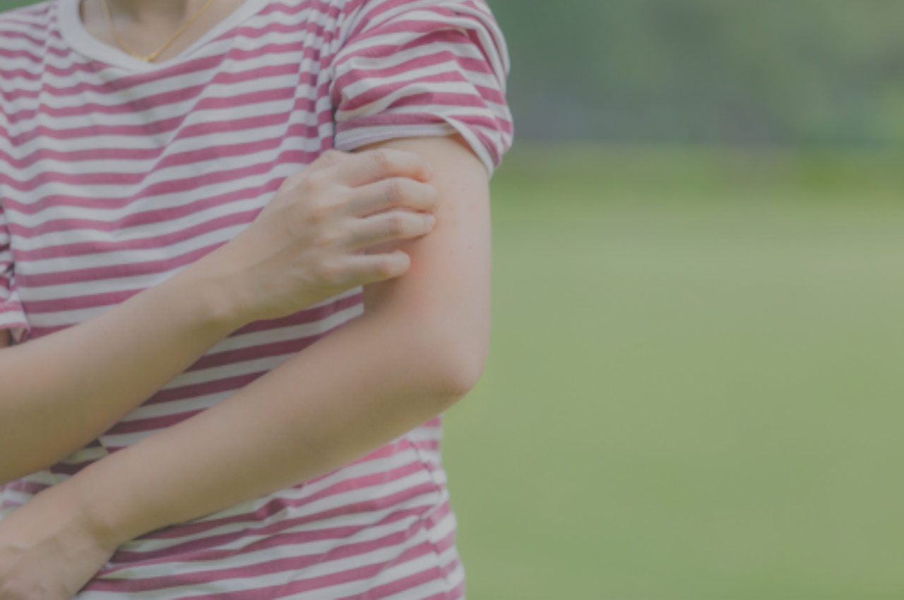 woman debating ringworm causes while scratching ringworm rash