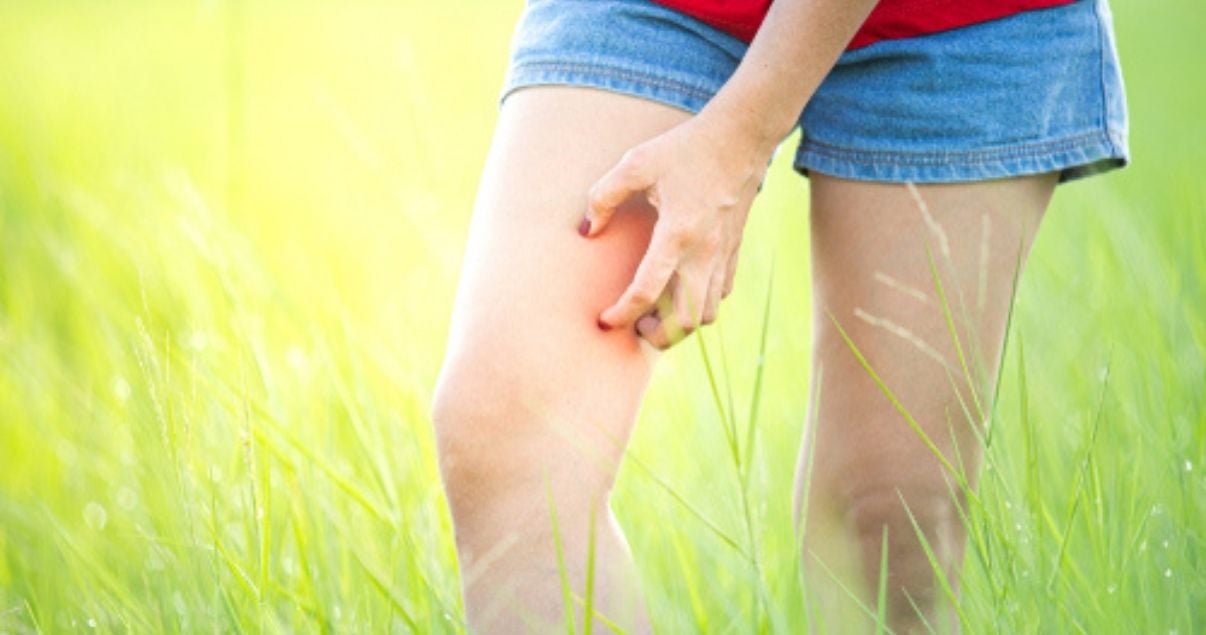 it can be hard to tell if itch is caused by ringworm or dry skin
