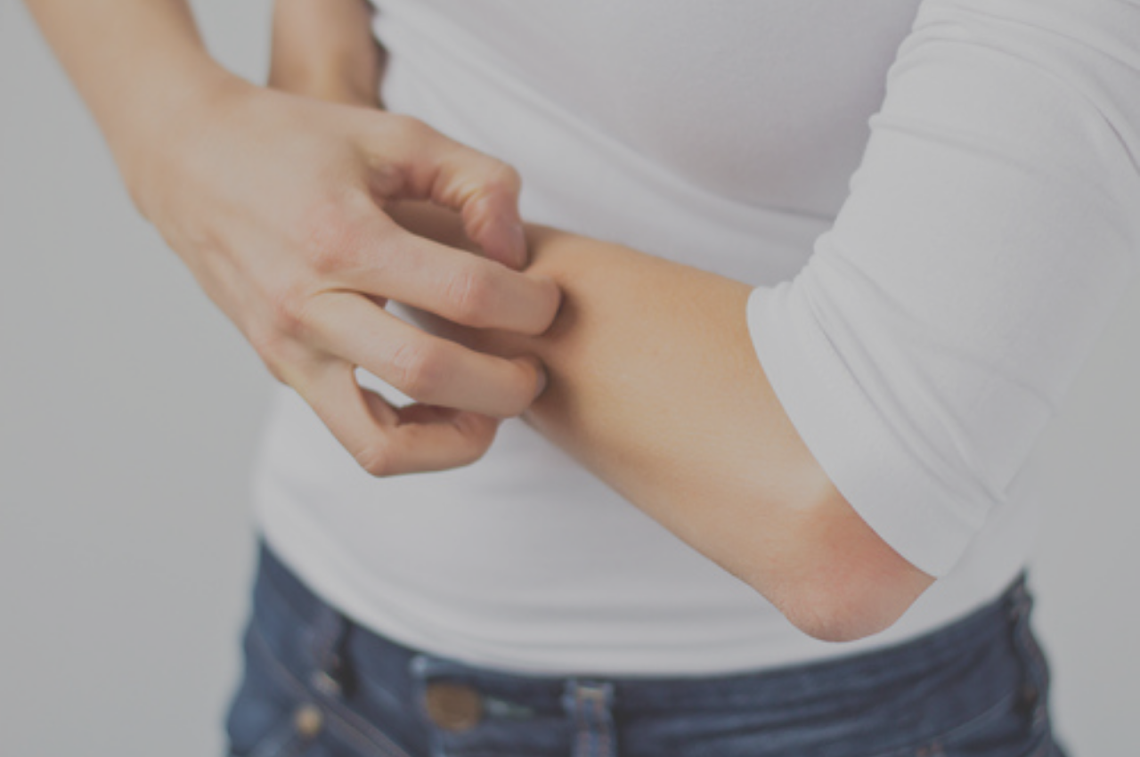 woman scratches dry skin which is one of the possible ringworm symptoms