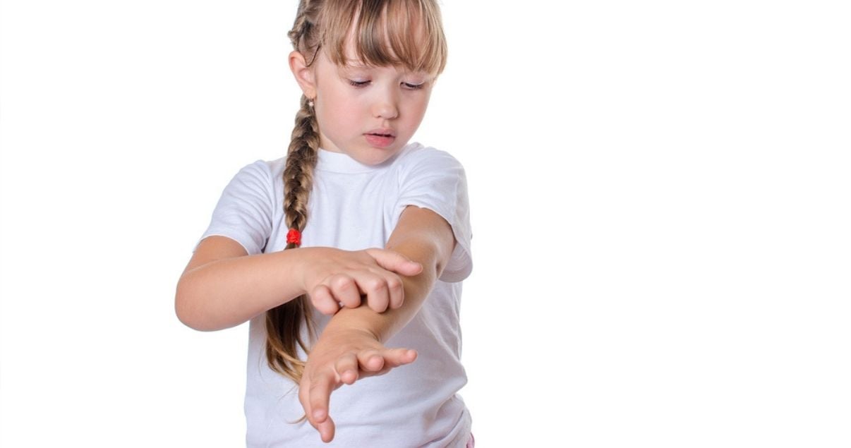 child scratching ringworm rash