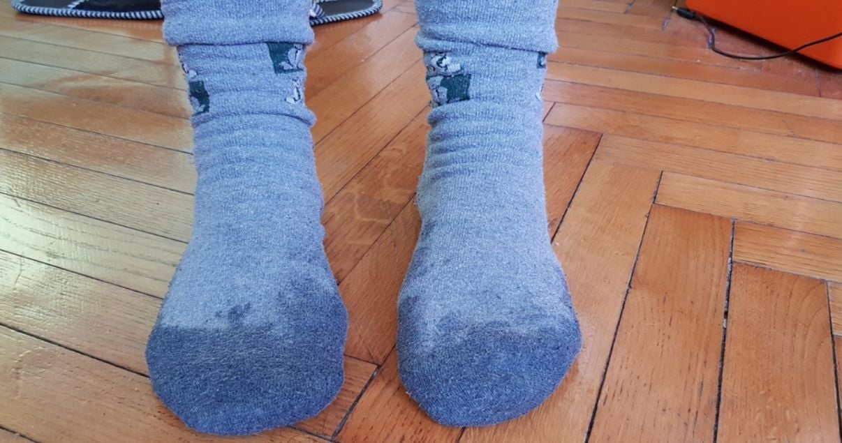 sweaty socks may cause foot fungus